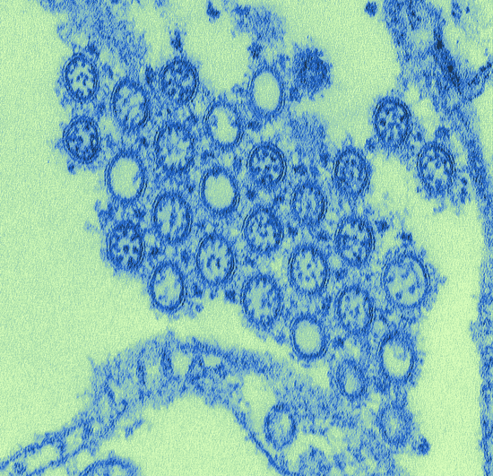 canva digitally colorized microscopic image of ah1n1 virions. courtesy of the public health image library centers for disease control and prevention cynthia goldsmith. MAD6oDE8GSc