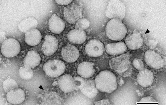 canva microscopic image of sars virions. courtesy of the public health image library centers for disease control and prevention charles d. humphery t.g. ksiazek. MAD6VzWN7D4