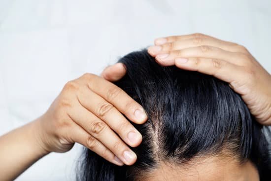 canva woman experiencing hair loss MAEMFivb004